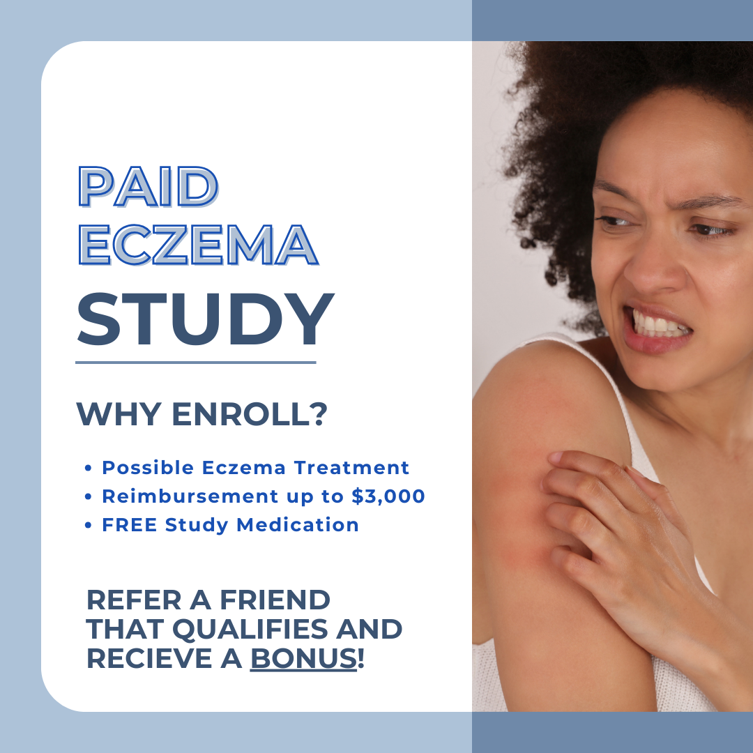 Moderate to Severe Atopic Dermatitis (Eczema) - Pasadena CA